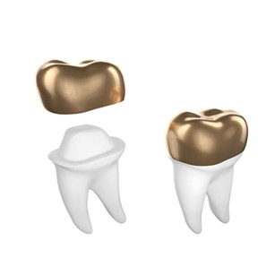 gold used in dental applications
